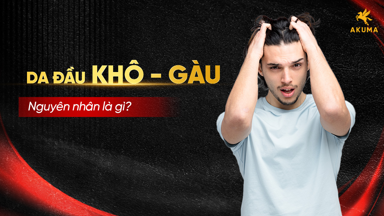Đầu bị gàu do đâu?